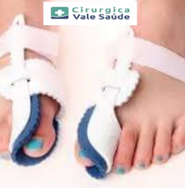 Imagem CORRETOR DE JOANETE Mod. HALLUX VALGUS